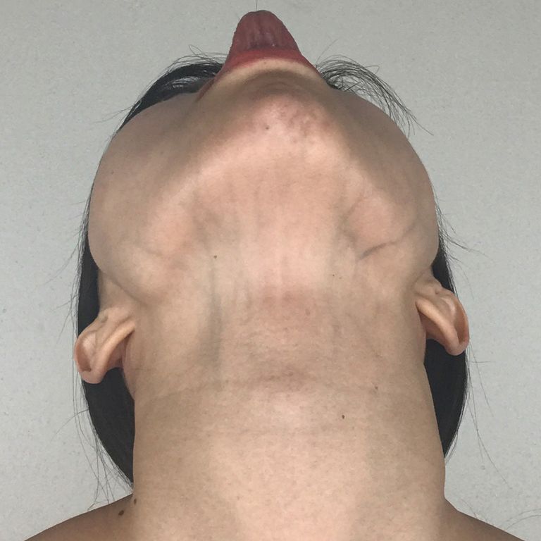 یوگای صورت برای جوانسازی عضلات گردن